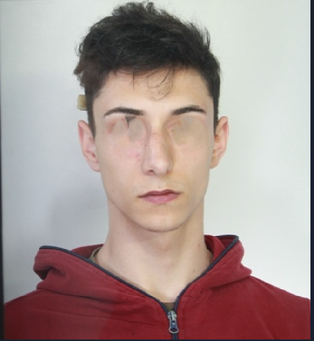 immagine importata