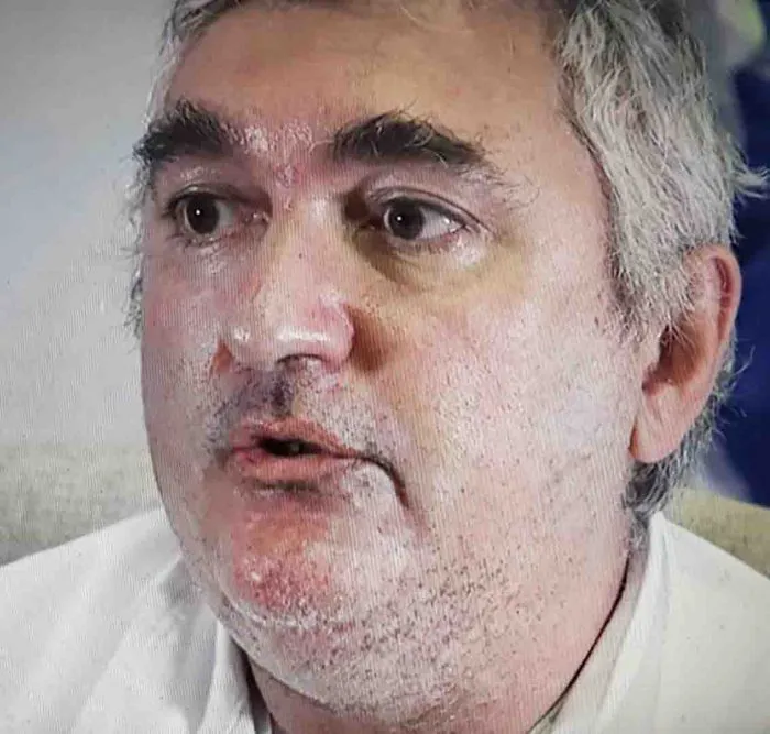 immagine importata